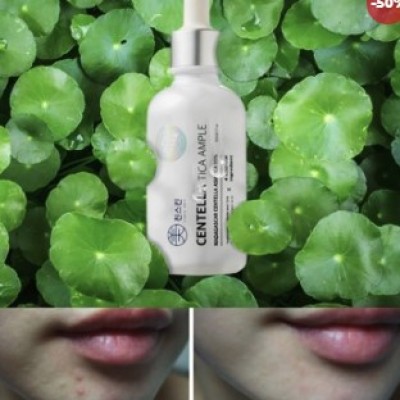 CRAZY SKIN 積雪草精華 (50ML)
